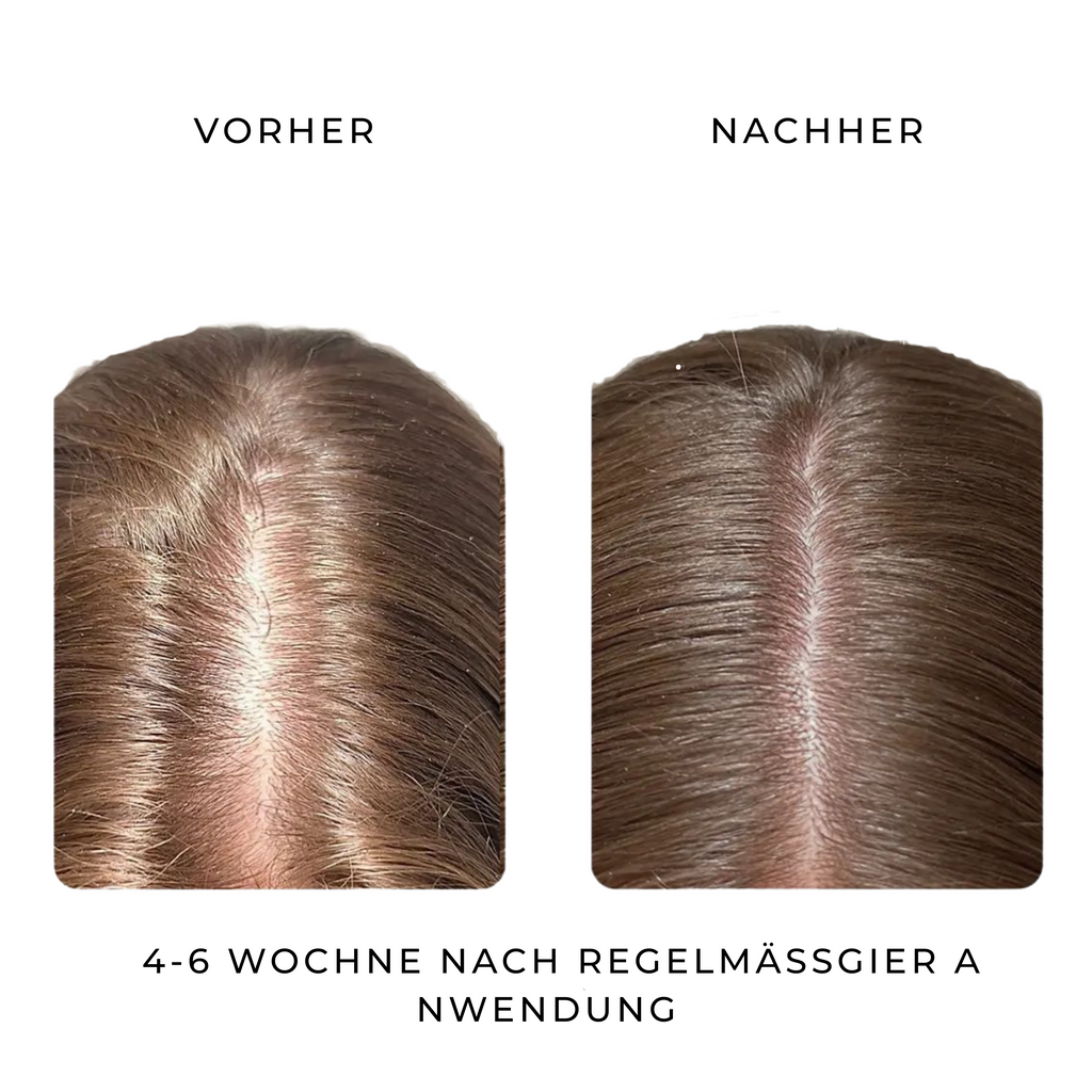 1x BUFSOU Scalp Essential Oil – Für starke Wurzeln & gesundes Haarwachstum