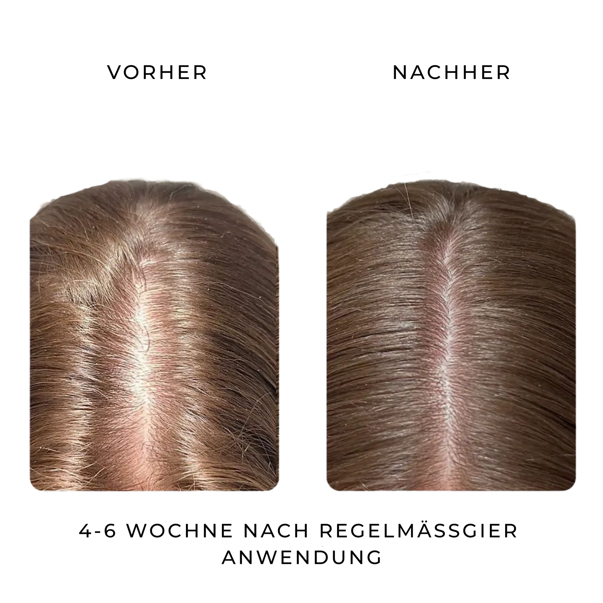 Veganic Scalp Essential Oil – Für starke Wurzeln & gesundes Haarwachstum